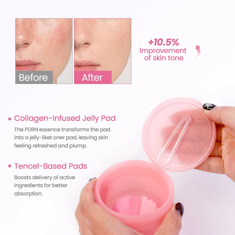 Pink Reset-PDRN Pink Collagen Toning Pads