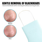 SUDS BUDS-Facial Cleansing + Pore Tool Set